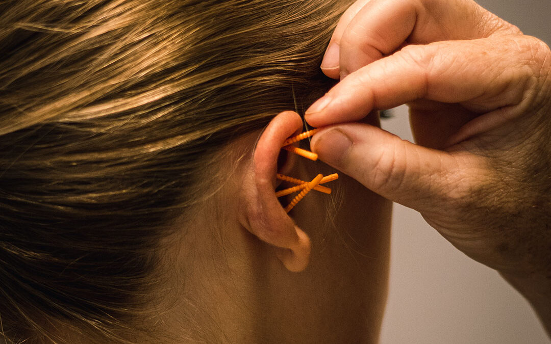 NADA-øreakupunktur kan hjælpe med at reducere stress, angst og spændinger for mere ro og balance i kroppen.