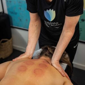 Behandling af ryg med massage og cupping som metode til at løsne spændinger og vise hvordan myoser kan masseres væk.