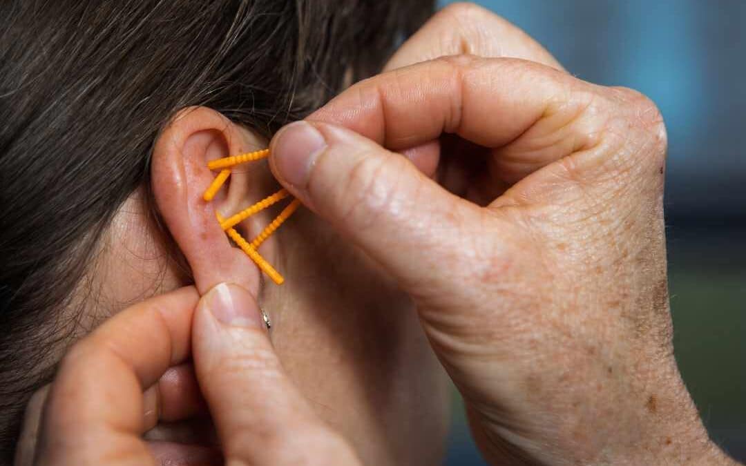 Gravid kvinde med NADA-akupunktur i øret som en del af skånsom behandling under graviditet.