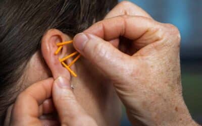 Graviditet og akupunktur