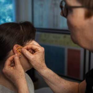 Akupunkturbehandling i øret udført af behandler som alternativ metode mod migræne og spændingshovedpine.