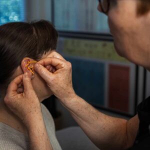 Behandling med akupunktur hvor NADA-nåle placeres i øret for at skabe ro og balance i kroppen.