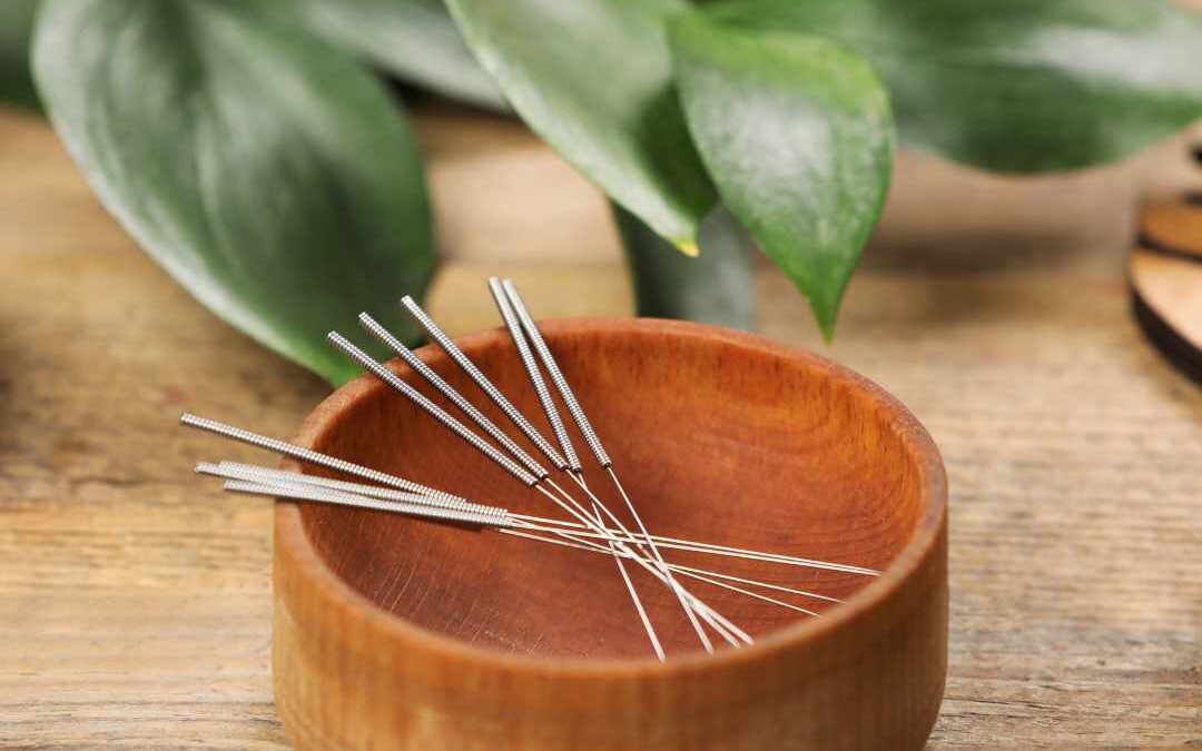 Akupunkturnåle klar til behandling med akupunktur, anvendt til skånsom og præcis stimulering af punkter.