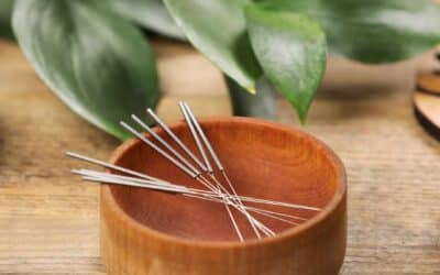 Behandling med akupunktur